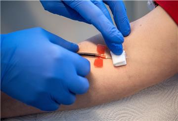 Bei der Plasma-Spende wird Blut abgenommen.