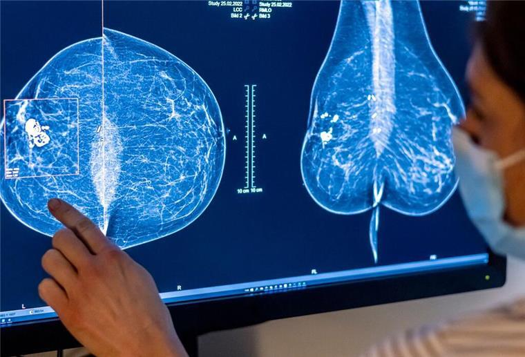 Ein Arzt schaut auf eine Mammografie