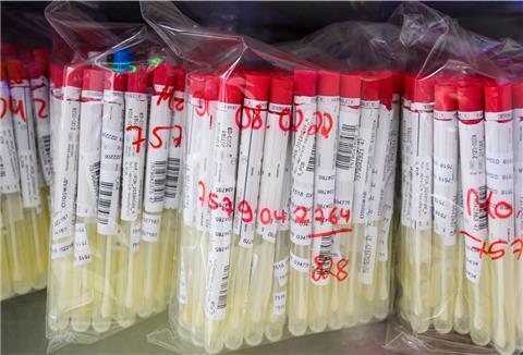 PCR-Tests von Patienten liegen im Labor Nordlab in einem Kühlschrank