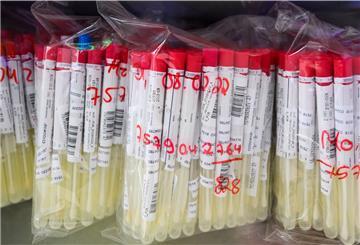 PCR-Tests von Patienten liegen im Labor Nordlab in einem Kühlschrank
