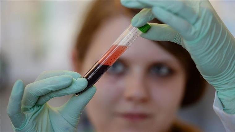 Barmer: Zahl der Schwangeren-Bluttests auf Trisomien steigt Der Anteil der schwangeren Frauen, die einen vorgeburtlichen Bluttest auf Trisomien vornehmen lassen, steigt nach Daten der Krankenkasse Barmer in Niedersachsen. (Symbolbild)
