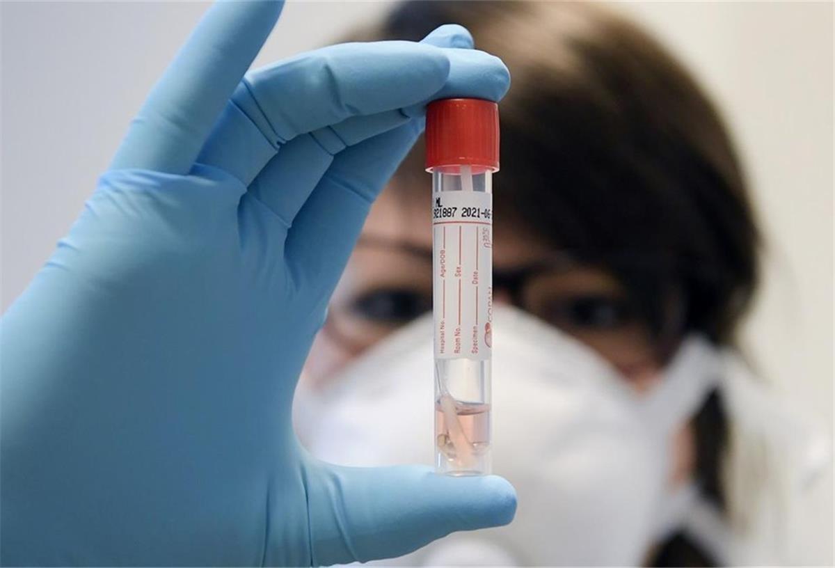 Die Anzahl der bestätigten Neuinfektionen mit dem Corona-Virus ist im Landkreis Cuxhaven noch einmal um 23 gestiegen.