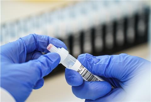 Die Mitarbeiterin eines Labors hält eine Probe in den Händen. Die zunächst in Großbritannien entdeckte Corona-Variante B.1.1.7 breitet sich nach Beobachtung eines großen Laborverbands in Deutschland weiter aus.