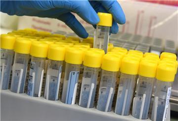 Im PCR-Labor am Institut für klinische Chemie und Laboratoriumsdiagnostik bereitet eine medizinisch technische Laborassistentin die Bearbeitung von PCR-Tests in einem Automaten vor, die innerhalb von drei Stunden in dem Automaten analysiert werden.