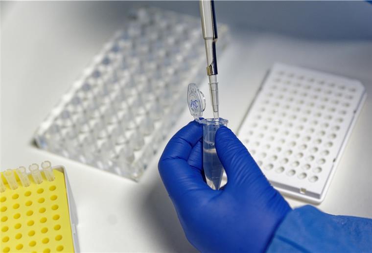 Coronakrise: Bundesweite Inzidenz steigt auf 1607,1 Eine Mitarbeiterin des Labors CBT füllt mit einer Pipette, zur Vorbereitung von PCR-Tests, eine Testflüssigkeit ein.