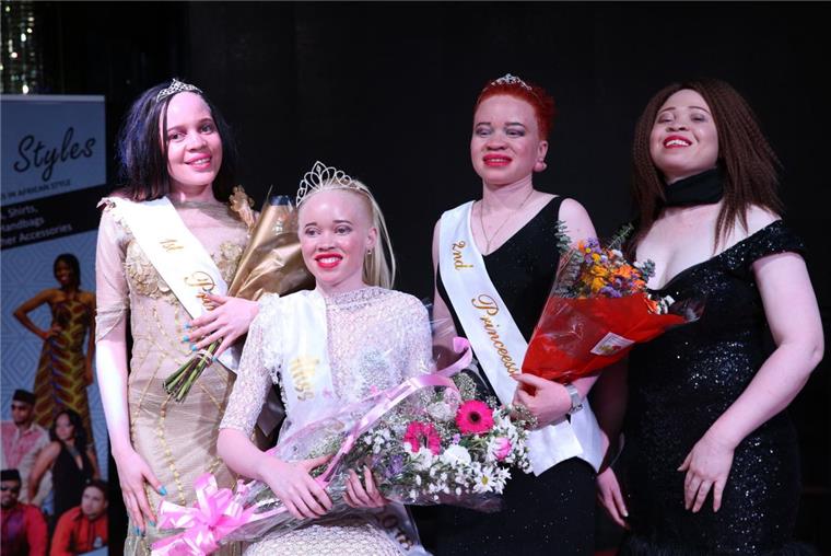 Erste "Miss Albino Simbabwe" gekürt - Kampf gegen das Stigma Die Schönheitskönigin trägt ein blütenweißes Kleid, passend zu ihrer hellen Haut und den hellen Haaren. Der einzige Farbklecks ist ihr roter Lippenstift. Stolz trägt Sithembiso Mutukura (vorne) ihre Krone: Sie ist "Miss Albino Simbabwe", die erste Siegerin eines Schönheitswettbewerbs für Menschen mit Albinismus in dem Land im Südosten Afrikas.