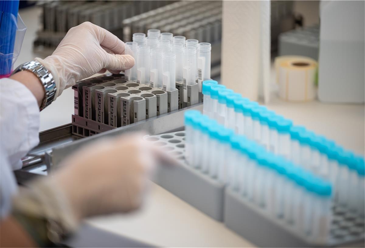 Corona: RKI registriert 35.431 Neuinfektionen Eine Labormitarbeiterin bereitet im Bioscientia MVZ Labor Mittelhessen Teströhrchen für einen PCR-Test vor.