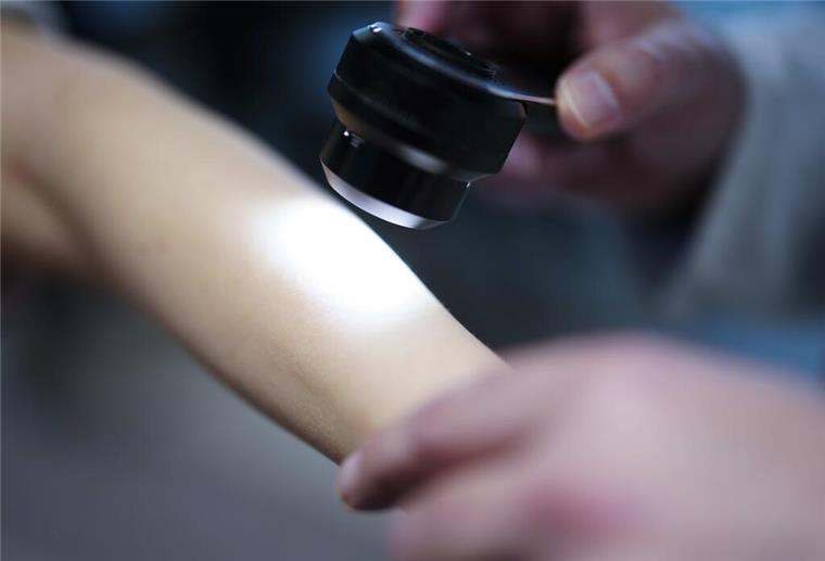 Schock für Patienten! In der Wesermarsch gibt es bald keinen Hautarzt mehr Die Tätigkeit von Hautärzten ist unter anderem für die Früherkennung von Hautkrebs wichtig. In der Wesermarsch wird es bald keinen Hautarzt mehr geben.