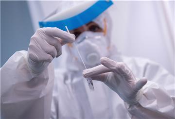 Die Testcenter in der Wesermarsch haben veränderte Öffnungszeiten während der Feiertage.