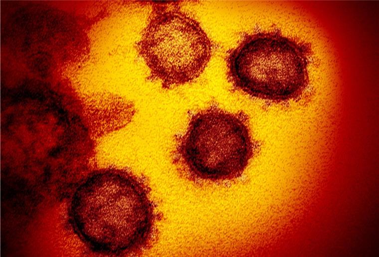Coronapatientin aus Visselhövede stirbt mit 46 Jahren Die vom National Institute of Allergy and Infectious Diseases zur Verfügung gestellte Elektronenmikroskopaufnahme zeigt das Coronavirus SARS-CoV-2, das von einem Patienten in den USA isoliert wurde und aus der Oberfläche von im Labor kultivierten Zellen austritt.