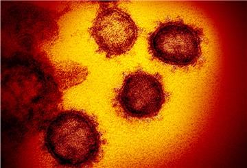 Die vom National Institute of Allergy and Infectious Diseases zur Verfügung gestellte Elektronenmikroskopaufnahme zeigt das Coronavirus SARS-CoV-2, das von einem Patienten in den USA isoliert wurde und aus der Oberfläche von im Labor kultivierten Zellen austritt.