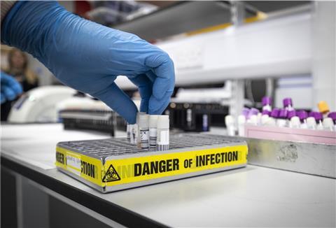 Ein Bremerhavener hat sich mit dem Corona-Virus infiziert.