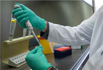Ein Forscher zeigt, wie ein PCR-Test für die Analyse auf Mutationen des Coronavirus vorbereitet wird.