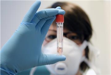 Ein Mitarbeiter der Agentur für Gesundheit und Ernährungssicherheit (AGES) in Österreich schaut auf einen Corona-Test im Labor.