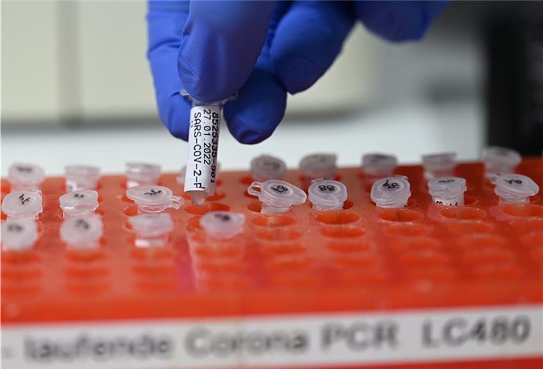 Corona: Positiv Getestete bekommen SMS oder E-Mail Eine Mitarbeiterin des PCR Testlabors bereitet PCR Tests vor.