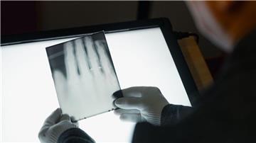 Ein Röntgenbild der Hand von Wilhelm Röntgen gehört nun zum  Unesco-Weltdokumentenerbe. (Archivbild)