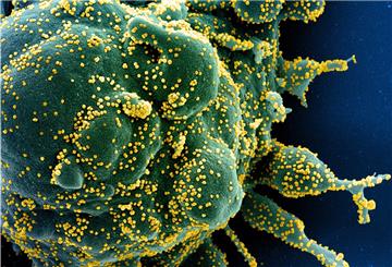Eine grüne Zelle ist mit dem Coronavirus (gelb) infiziert. Im Landkreis Rotenburg ist die Zahl der Corona-Infizierten derzeit stabil.