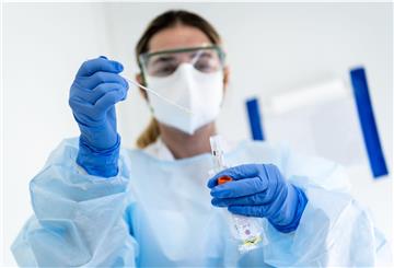 Eine Labor-Mitarbeiterin testet eine Speichelprobe auf Corona: Nachdem beim Fallgeschehen in einem Betrieb in Bremervörde neben der Variante B 1.1.7 auch die südafrikanischen Variante B 1.351 entdeckt wurde, hat das Gesundheitsamt am Montag noch einmal den Teil der Mitarbeiter abgestrichen, bei denen noch keine Ergebnisse vorlagen.