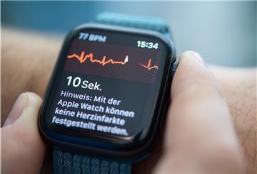 Eine Smartwatch zeigt die Pulsfrequenz an.