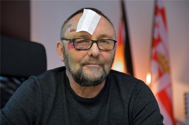 Frank Magnitz, Landesvorsitzender der AfD Bremen, wurde im Januar von unbekannten Tätern angegriffen.
