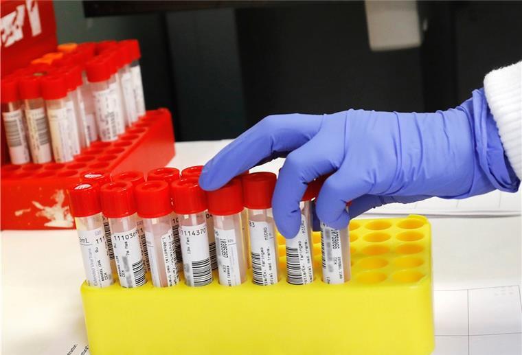 Zahl der Corona-Fälle in Schlachthof steigt auf über 120 Ein Mikrobiologe untersucht im Labor Proben für PCR-Tests