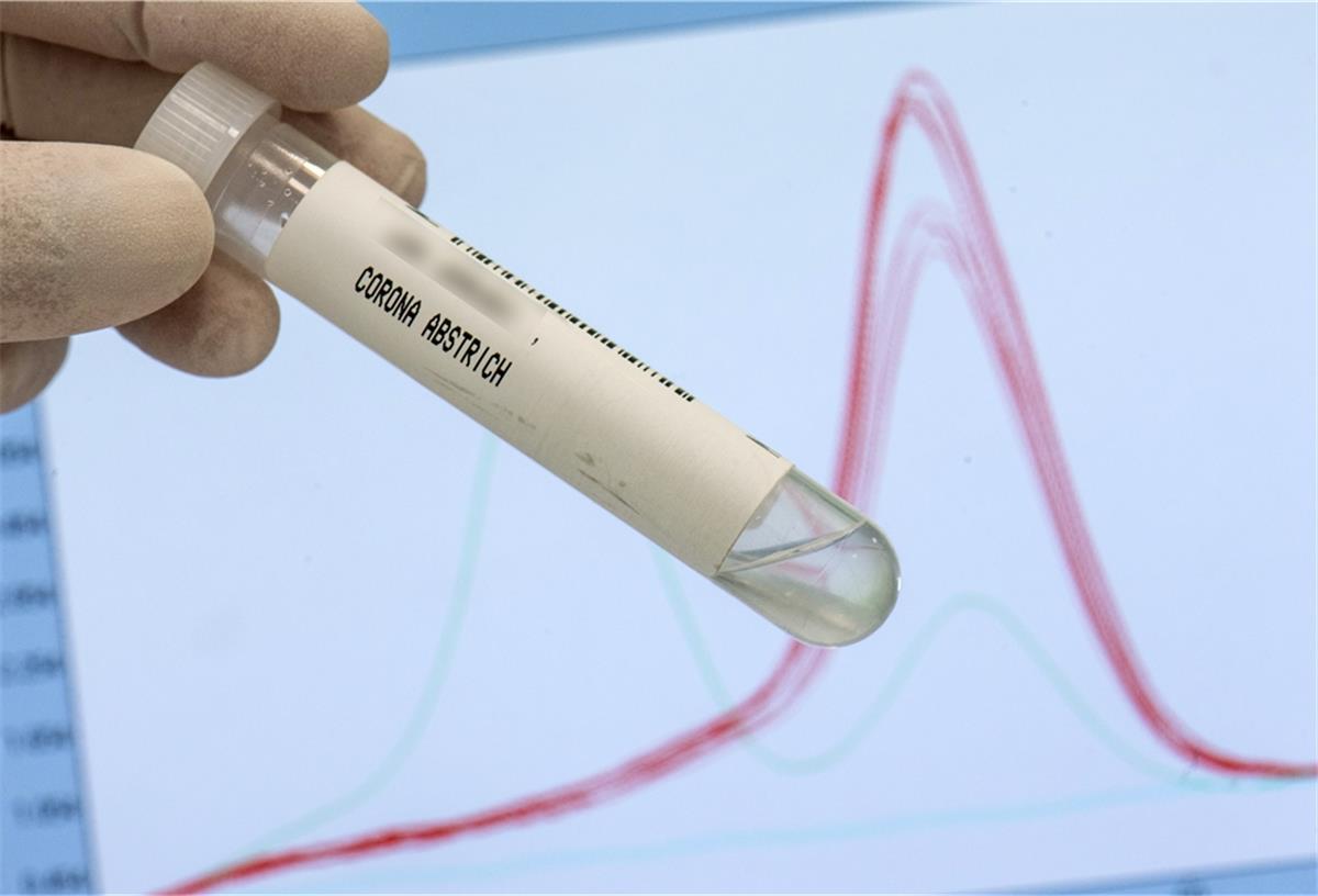 Gleich 17 Corona-Neuinfektionen im Cuxland Ein leeres Abstrichröhrchen zur Analyse des Corona-Virus wird im Labor der Firma „Bioscientia“ zu Illustrationszwecken vor einen Monitor gehalten, auf dem ein sogenannter „Schmelzkurvenverlauf“ der „Delta-Variante“ des Virus dargestellt ist.