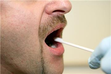 Immer häufiger greift die niedersächsische Polizei zu DNA-Tests. 