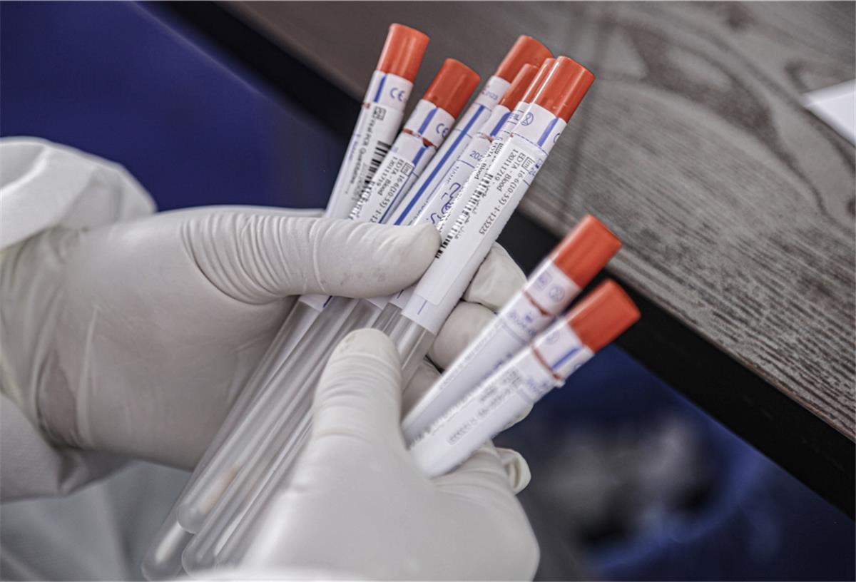 In Bremerhaven haben sich bislang 202 Menschen mit dem Coronavirus infiziert.