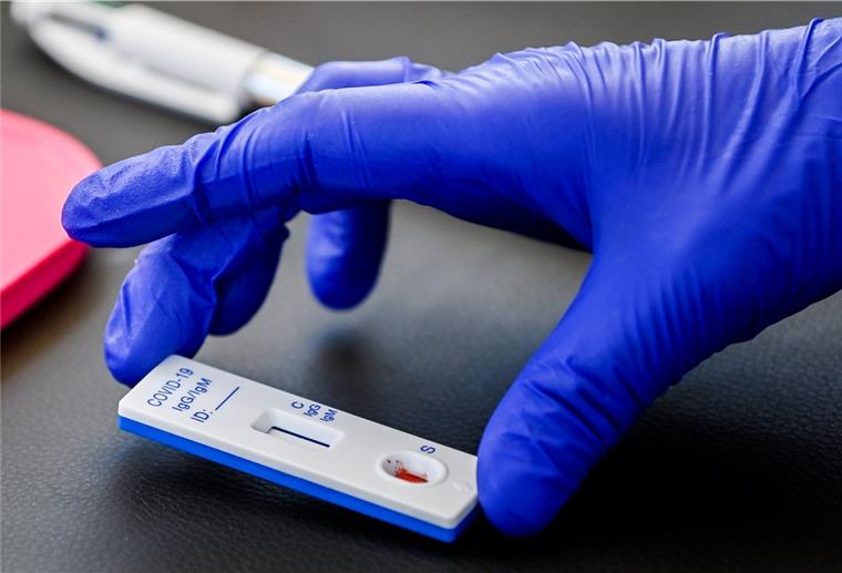 Wegen Corona: Stahlbau Nord wird vorübergehend geschlossen Ein Test für das neuartige Coronavirus wird im Stadtzentrum in einer Hand gehalten.