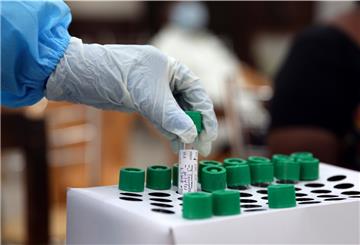 Ein Mitarbeiter des Gesundheitswesens hält in einem Regierungsbüro in Chennai eine Probe für einen RT-PCR-Test in der Hand.