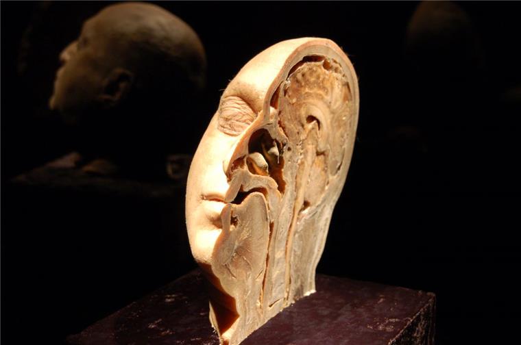 In Bremerhaven wird die nachgeahmte Körperwelten-Ausstellung nicht gezeigt. Sie bekam vom Bürger- und Ordnungsamt keine Genehmigung. 