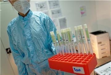 Teststäbchen stehen im Labor CBT zur Auswertung mit einem Corona PCR Test in einer Halterung.