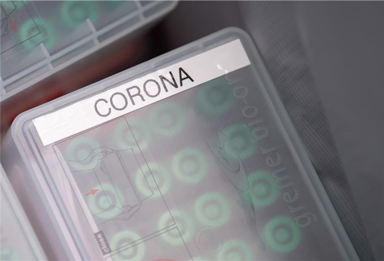 In Deutschland wurden am Sonntag 436 Infektionen mit dem Coronavirus gemeldet.