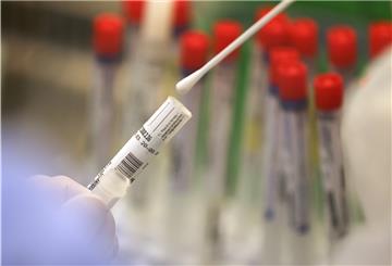 In Quarantäne befinden sich nach wie vor 16 Wesermärschler, wovon elf als Kontaktperson gelten.