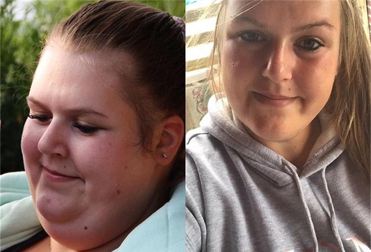 Lunestedt: Neues Leben durch Magen-OP Lange fühlte sich Lena Schmidt unwohl mit ihrem Körper - bis sie selbst etwas dagegen unternahm.