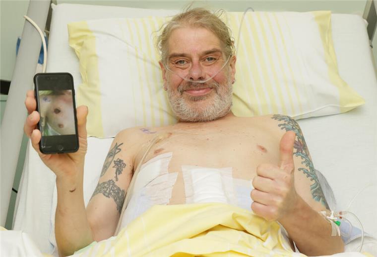 55-Jähriger wird von Zaunstange aufgespießt - und überlebt 55-Jähriger wird von Zaunstange aufgespießt - und überlebt