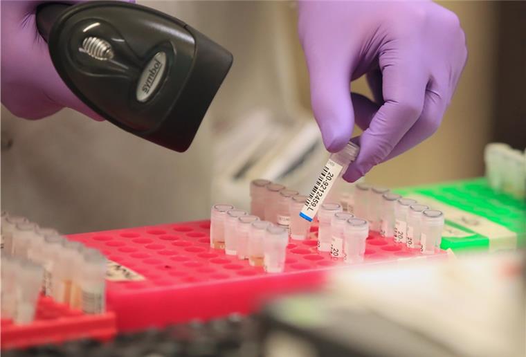 Liveticker Coronavirus (Dienstag, 17. März): Zahlen in Bremerhaven und Cuxland steigen Proben werden in einem Labor auf Coronavirus (Covid-19) getestet.