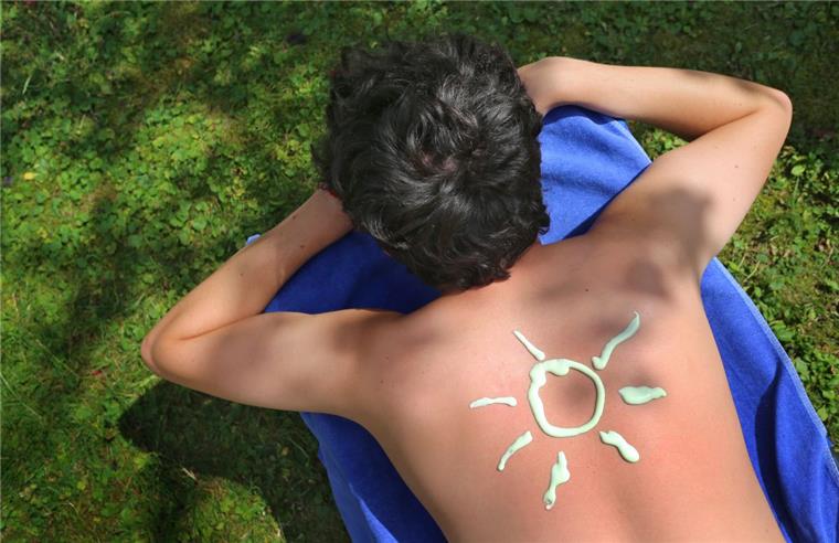 Regelmäßiges Auftragen von Sonnencreme schützt die Haut vor der intensiven UV-Strahlung. Man sollte die Creme - anders als auf dem Foto - jedoch gleichmäßig verteilen.