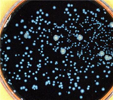 So sieht eine Kolonie des Bakteriums Legionella pneumophila aus. Es löst die so genannte Legionärskrankheit aus.