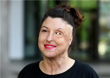 Vanessa Münstermann, Opfer eines Säure-Anschlags,  hat geheiratet. 