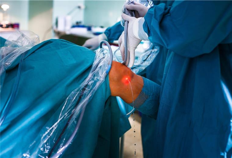 Corona: Kliniken müssen Operationen verschieben Wegen der Corona-Pandemie mussten die Kliniken viele planbare Eingriffe wie Knie-Operationen absagen oder verschieben.