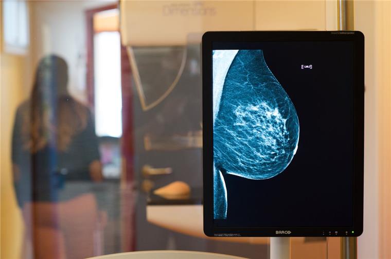 Zur Brustkrebsvorsorge, der Mammografie, gehen in Bremerhaven und Bremen 57 Prozent der bei der AOK versicherten 50 bis 69 Jahre alten Frauen. 